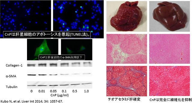 コノフィリン（CnP）の肝星細胞の抑制効果 画像